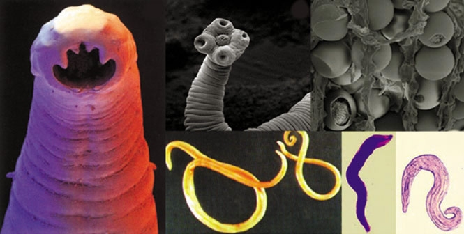 Human parasites and intestinal worms are more common than you think!